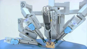 機(jī)器人制霸手術(shù)臺(tái) 外企壟斷格局下，國(guó)產(chǎn)普通機(jī)械制造的突圍之路